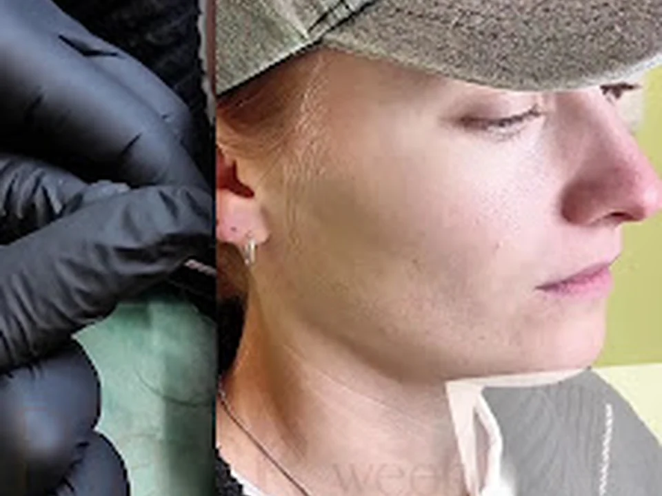 Piercing Stockholm – Öronhåltagning